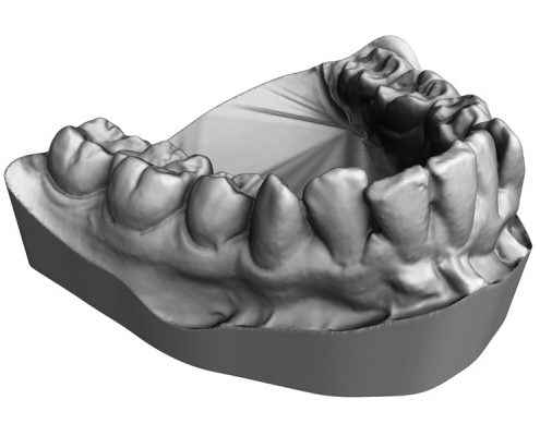 Teeth 3D Scanning Service Europac 3D